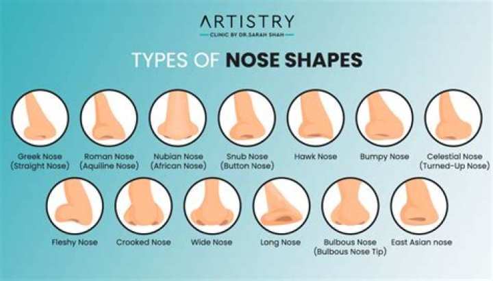 A Journey Through Chart Nose Types