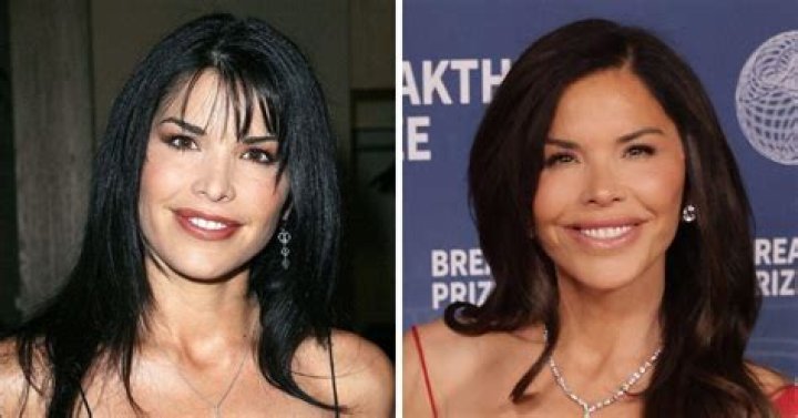 Before And After Plastic Surgery Photo ·