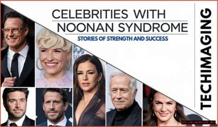 Celebrities Reshaping The Narrative Of Noonan Syndrome