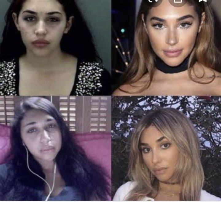 Chantel Jeffries Plastic Surgery Before And After ·