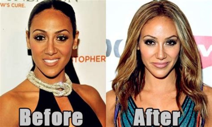 Melissa Gorga Net worth, House, Plastic Surgery, Nose Job.